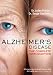 Alzheimer's Disease: The Complete Introduction (Your Health Book 1) by Judes Poirier, Serge Gauthier