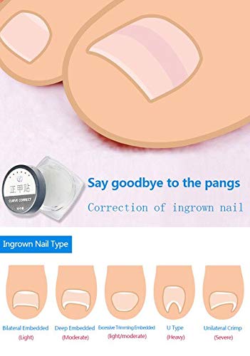 Buy Beautyneeds 10pcs Box Ingrown Toe Nail Correction Sticker