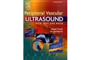 Peripheral Vascular Ultrasound: How, Why and When