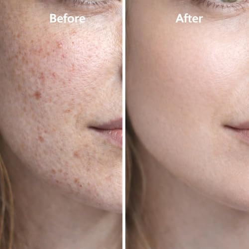 YOOJ® GHK‑Cu Copper Peptide Face Serum, Anti‑Aging Hydrating Repair Serum, Skin Barrier Repair & Lightweight Moisturizer for Daily Skincare, 30ml