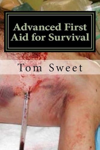 Download Advanced First Aid for Survival: When the Sh*t Hits the Fan YOU Are the Docotr PDF