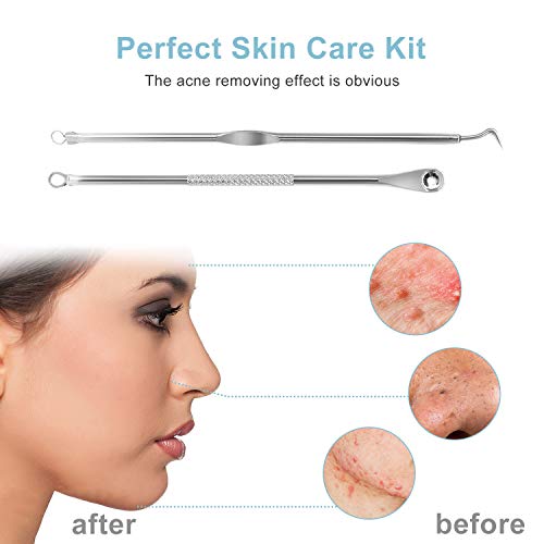 16 Heads Blackhead Acne Removal, Acne Acne Extract, Whitehead Acne