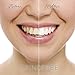 Teeth Whitening Strips - Instantly Whiter Brighter Teeth - Best Whitener Available - 28 Treatments - Makes Every Tooth as White as Possible