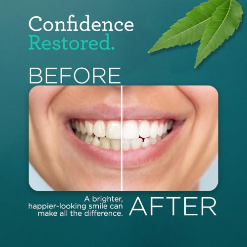 GuruNanda Hydroxyapatite Toothpaste for Whitening with Neem & Xylitol, SLS & Fluoride Free (4 Pack) - Freshens Breath, Fights Plaque - with 2 Toothbrushes, 2 Tongue Scrapers & 2 Tube Squeezers