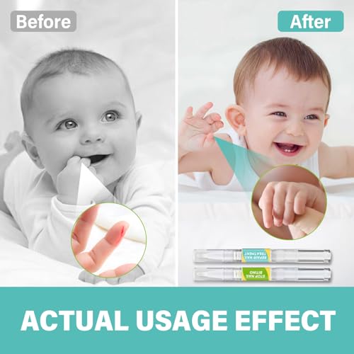 Nail Biting Treatment for Kids Bitter Taste & Non Glossy Nail Polish