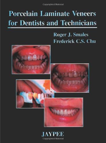 Porcelain Laminate Veneers for Dentists and Technicians