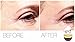 -417 Miracle Immediate Wrinkle Filler-1 oz.