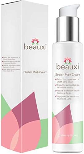 products to reduce stretch marks