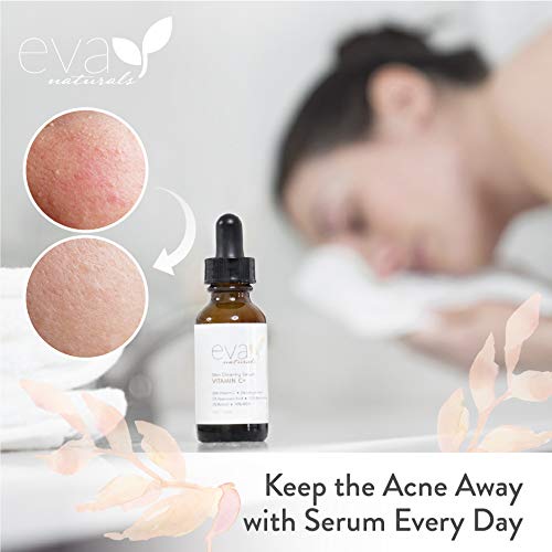eva naturals for acne
