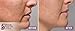 Biotech, Dermasilk 5 Min Face Lift Immediately Lifts, Tightens and Firms Aged Skin - Anti Aging Skin Cream - Last up to 8 Hours Significantly Reduces the Appearance of Fine Lines, Wrinkles and Sagging Skin 1 oz