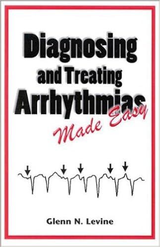 Diagnosing Treating Arrhythmias Made Easy Levine Glenn N 9781576261064 Amazon Com Books