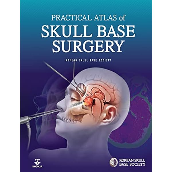 健康・医学 Surgical anatomy of the skull base This is a human skull, through the eyes of a surgeon. Every hole