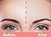 APRICOT beauty & healthcare Apricot Skin facial patches (FOREHEAD)