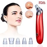 Blackhead Remover – Vacuum Suction Pore Cleanser & Pimple Popper – Comedone Extractor Acne Removal Cleansing Tool by Noel – Includes 5 Heads, 2 Silica Gel Rings, 5 Sponges – Unisex Facial Clean Kit