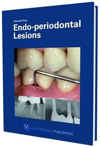 Download Endo-Periodontal Lesions PDF