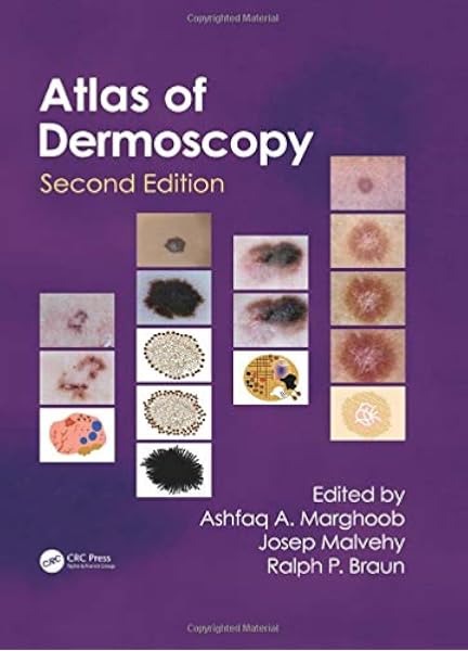 An Atlas Of Dermoscopy 9780415458955 Medicine Health Science Books Amazon Com