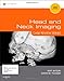 Head and Neck Imaging: Case Review Series