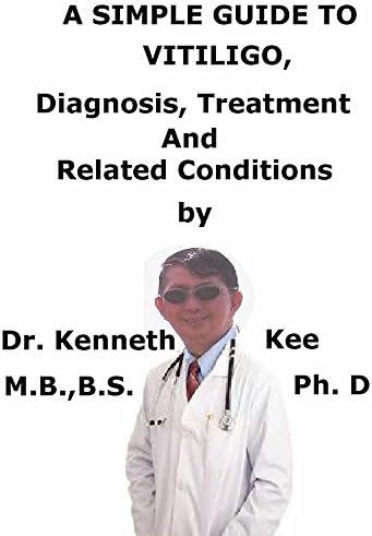 A  Simple  Guide  To  Vitiligo,  Diagnosis, Treatment  And Related Conditions (A Simple Guide to Medical Conditions)