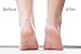 Foot Peel Mask 2 Pairs Foot Peeling Mask For Soft Feet - Foot Peeling Gel - Socks Booties Soft & Smooth Feet For Men And Women - Result - Your feet become like Baby feet