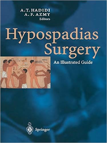 Amazon Com Hypospadias Surgery An Illustrated Guide Hadidi Ahmed David A Montgomery Libros