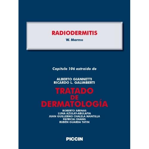 Capítulo 106 extraído de Tratado de Dermatología - RADIODERMITIS Capítulo 106 extraído de Tratado de Dermatología - RADIODERMITIS