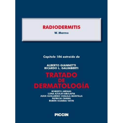 Capítulo 106 extraído de Tratado de Dermatología - RADIODERMITIS