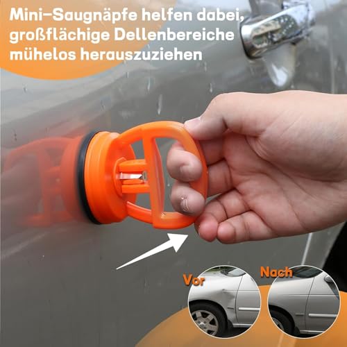 PDR Car Dent Repair Kit, Paint-Free Dent Removal Tool Set, Toothpuller, Suction Cup and Tool for Body, Ideal for Medium and Small Dents, Hail Damage and Dents