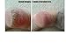 Foot Repair Serum - Eliminates Dry, Cracked Heels Fast! More concentrated than any creams, heel sticks or lotions!