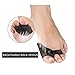 Breathable Orthopedic Bunion Corrector & Splint Kit for Women by BEZBOLY - Pain Relief in Hammer Toe Straightener, Hallux Valgus - Toe Pads for Big Toe, Pinky Toe Corrector de Juanetes