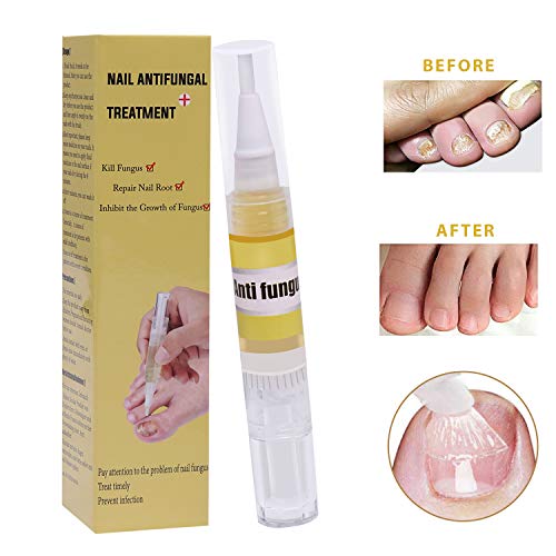 Buy Nail Fungus Fungus Stop Pen Anti fungal Nail Solution for Toenails