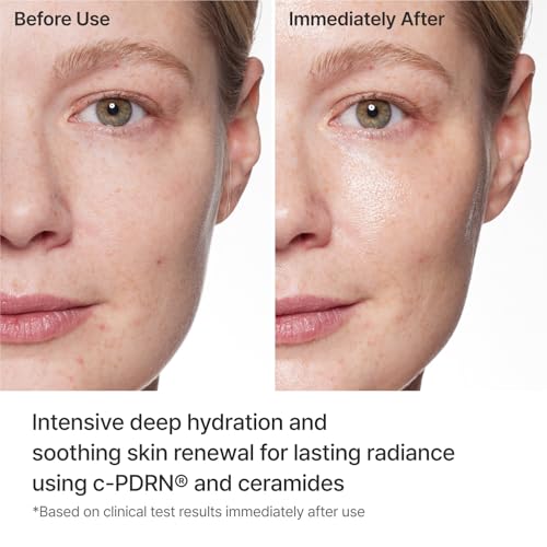REJURAN® Turnover Mask, c-PDRN® (5ea) – Original Salmon DNA for Firming, Hydration, Repairing & Revitalizing. Achieve Youthful, Radiant Skin. Korean Skincare. Ultra Microfiber Sheet Mask