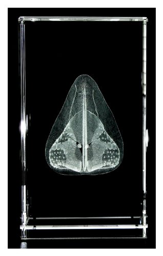 Nose 3d Laser 1lb Crystal, Anatomy, Rhinology Model