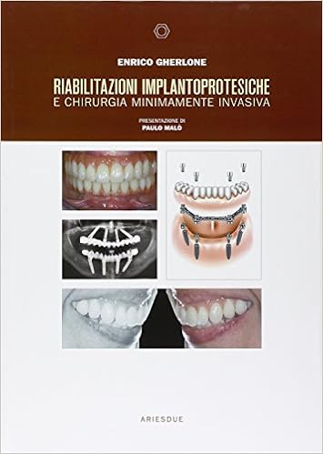Riabilitazioni Implantoprotesiche E Chirurgia Minimamente Invasiva Amazon It Gherlone Enrico F Libri
