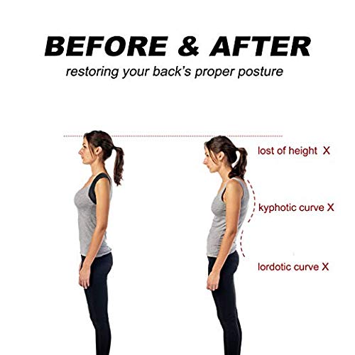 Hecmoks Posture Corrector Back Support Brace for Men and Women - Improves Posture, Prevents Slouching and Hunching, Reliefs Upper Back and Neck Pain - Adjustable and Comfortable with Underarm Pads
