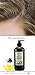 Hair Loss Therapy Shampoo | Best Shampoo for Healthy Looking Hair | Nutritive Ingredients Feed and Hydrate Hairthumb 3