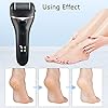 ZOUYUE-Electric-Foot-File-Pedicure-Set-Rechargeable-Waterproof-Hard-Skin-Remover-with-3-Rollers-and-2-Speeds-Callus-Remover-Foot-Care-Gift-Kit-for-Cracked-Heels-Calluses-and-Dead-SkinBlack ZOUYUE Electric Foot File Pedicure Set, Rechargeable Waterproof Hard Skin Remover with 3 Rollers and 2 Speeds, Callus…