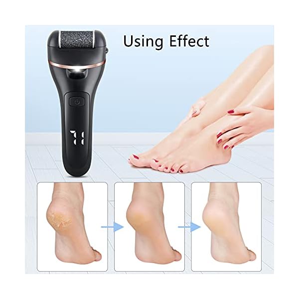 ZOUYUE-Electric-Foot-File-Pedicure-Set-Rechargeable-Waterproof-Hard-Skin-Remover-with-3-Rollers-and-2-Speeds-Callus-Remover-Foot-Care-Gift-Kit-for-Cracked-Heels-Calluses-and-Dead-SkinBlack ZOUYUE Electric Foot File Pedicure Set, Rechargeable Waterproof Hard Skin Remover with 3 Rollers and 2 Speeds, Callus…