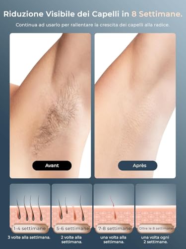 Pulsed Light Epilator with Ice Cooling Function, LCD Touch Screen, Automatic Scrolling Mode, Pulsed Light Epilator for Women and Men, Face, Armpits, Bikini, Body