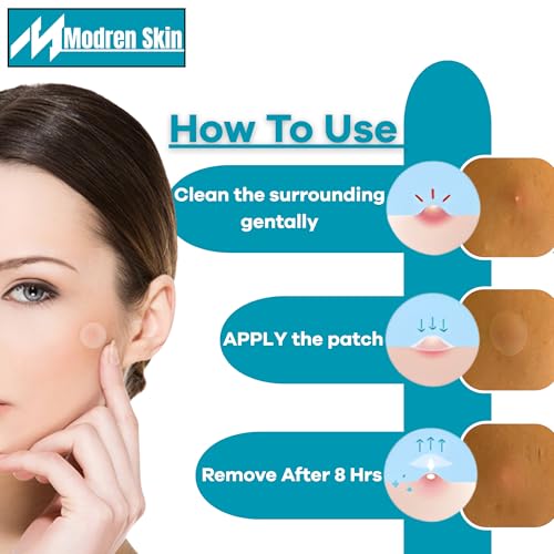 MODREN SKIN – 144 Pcs Pimple patches 4 Sheets – Hydrocolloid pimple patch with easy peel off cut lines in a resealable zipper bag – Acne Patch dots (Small 8mm, Medium 10mm)