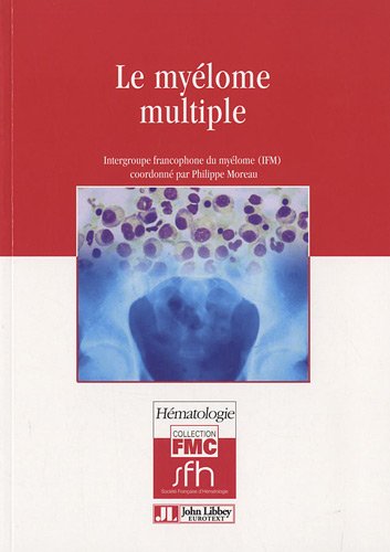 Le  myélome multiple