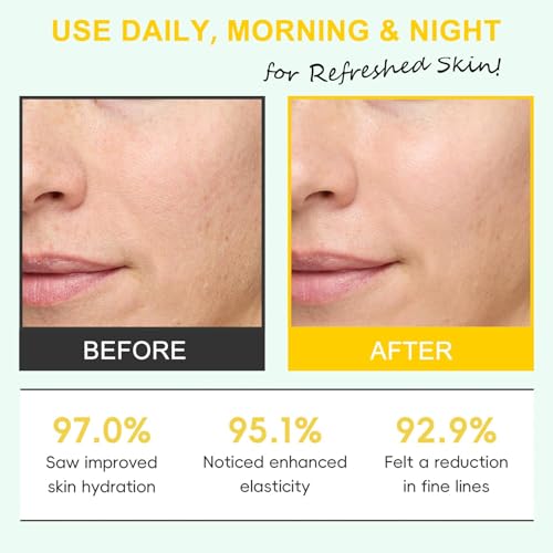 LBOYLOVE® White Truffle First Spray Serum, Hydrating Face Mist For Dry And Sensitive Skin, Dark Spot Correcting Glow Serum Multifunctional Spray, Body Mist For Women & Men, Vegan Korean Skincare