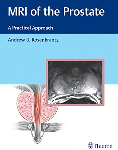 Download MRI of the Prostate: A Practical Approach (English Edition) PDF