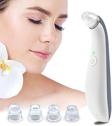 Blackhead Remover Vacuum, Upra Suction Facial Pore Cleaner Electric Comedo Suction Microdermabrasion Machine, Acne Comedone Extractor Kit with 4 Replaceable Suction Head, for Men and Women