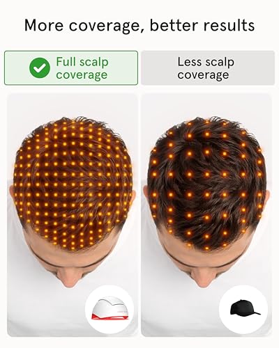 iRestore Professional Laser Hair Growth System-FDA Cleared Laser Cap Hair Growth for Men & Hair Regrowth Treatments for Women, Hair Loss Treatments Hair Cap, Like Laser Comb for Hair Growth Products