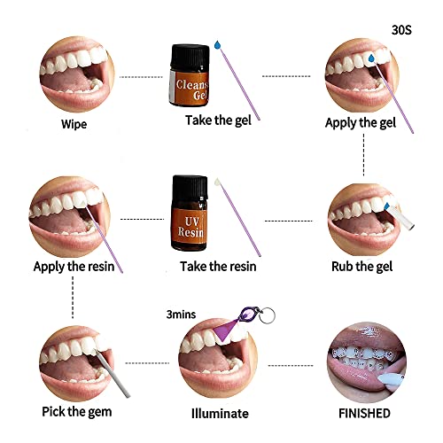 Frolika Tooth Gem Kit with UV Light and Glue DIY Kits 25 Gem Pieces Tooth Gem Kit with Curing
