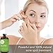 Tea Tree Essential Oil, 4 Fl Oz with Dropper - Undiluted Therapeutic Grade for Your Face, Skin, Hair and Diffuser - 100% Pure Melaleuca Oil for Acne, Toenails - by Pure Body Naturals