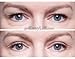 EasyLift The Original 60 Second Eye Lift | As Seen On TV | Lab Tested For Save Everyday Use | Made In the USA