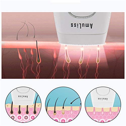 Transer Permanent Hair Removal Device for Women and Men Home Use Hair Removal System for Face Underarm, Bikini Area, Arms, Legs, Chest, Back and Atomach, Compact Hair Removal Epilator (White)