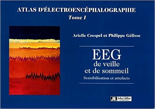 Amazon Fr Atlas D Electroencephalographie Tome I Eeg De Veille Et De Sommeil Sensibilisation Et Artefacts Crespel Arielle Gelisse Philippe Livres
