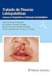 Livro Tratado de Fissuras Labiopalatinas: Avanços no Diagnóstico e Tratamento Interdisciplinar